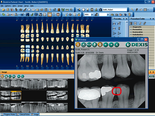 logiciels dentaires Dentrix Ascend